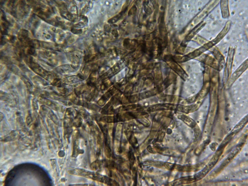 Butyriboletus appendiculatus 16 Cutícula